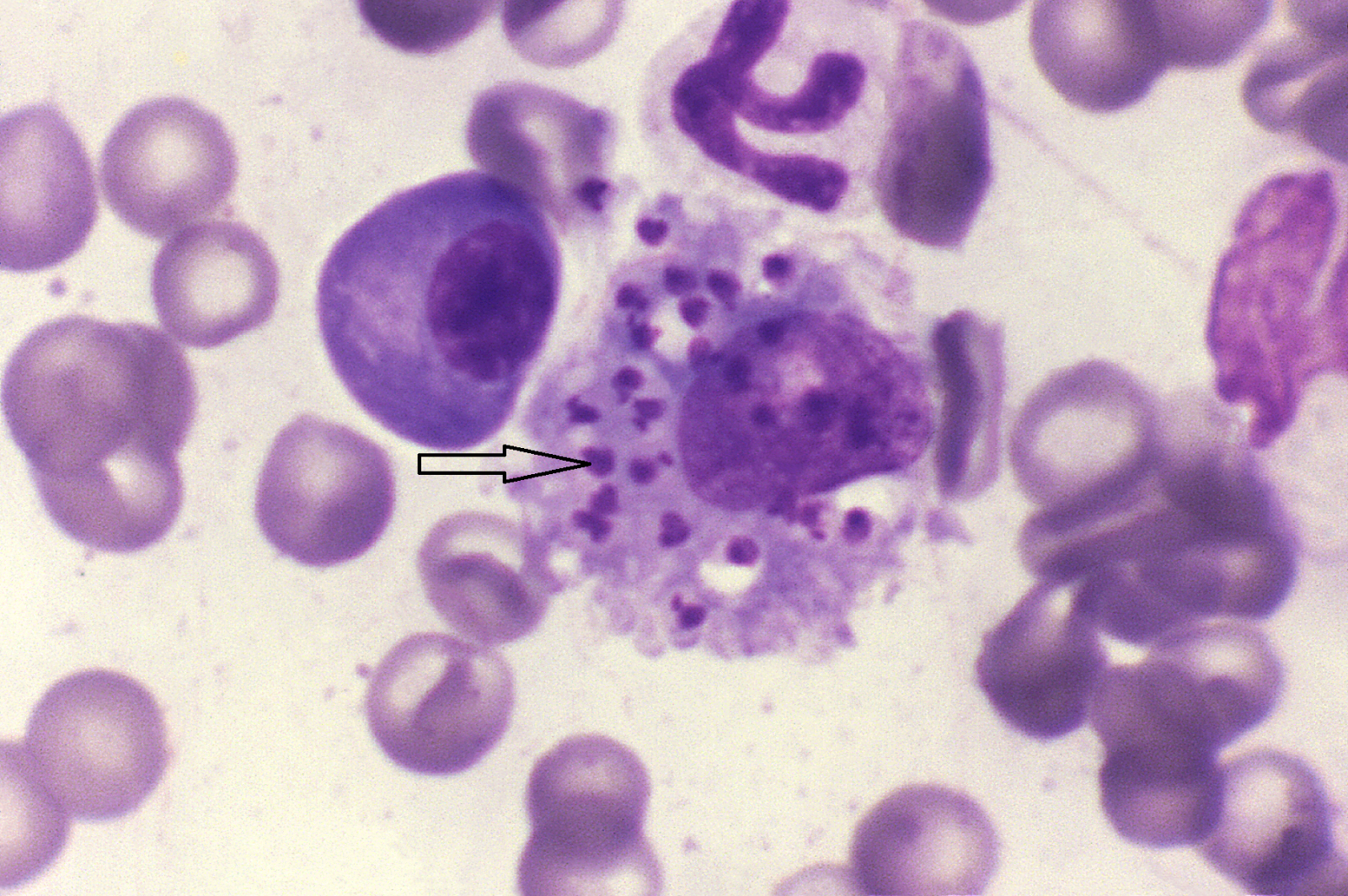 Leishmania_infantum_in_dog