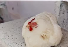 benh-ho-hap-man-tinh-chronic-respiratory-disease-crd