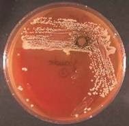 benh-say-thai-truyen-nhiem-o-bo-bovine-brucellosis