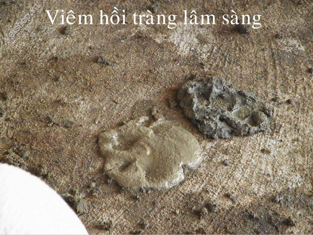 benh-viem-hoi-trang-do-lawsonia-intracellularis-o-heo 9