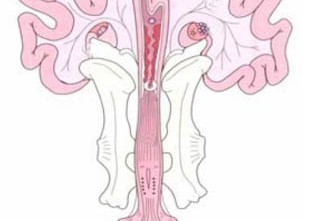 cac-benh-sinh-san-thuong-gap-o-heo-nai-sau-khi-sinh