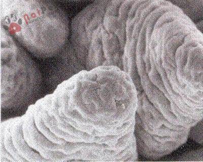 benh-cau-trung-o-heo-isospora-suis 5