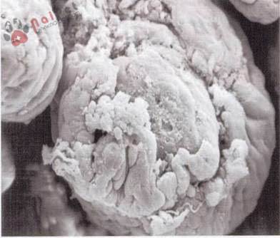 benh-cau-trung-o-heo-isospora-suis 6