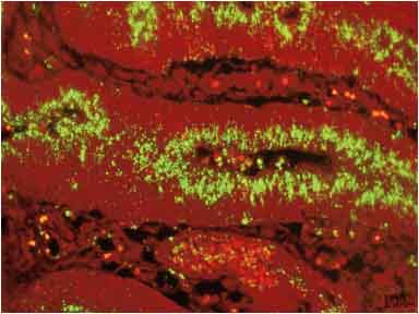 nhung-benh-ly-noi-troi-cua-heo 1