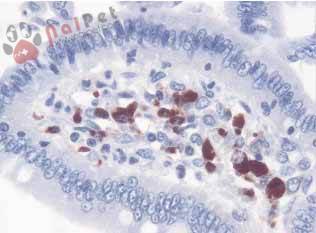 nhung-benh-ly-noi-troi-cua-heo 2