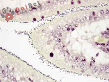 nhung-benh-ly-noi-troi-cua-heo 3